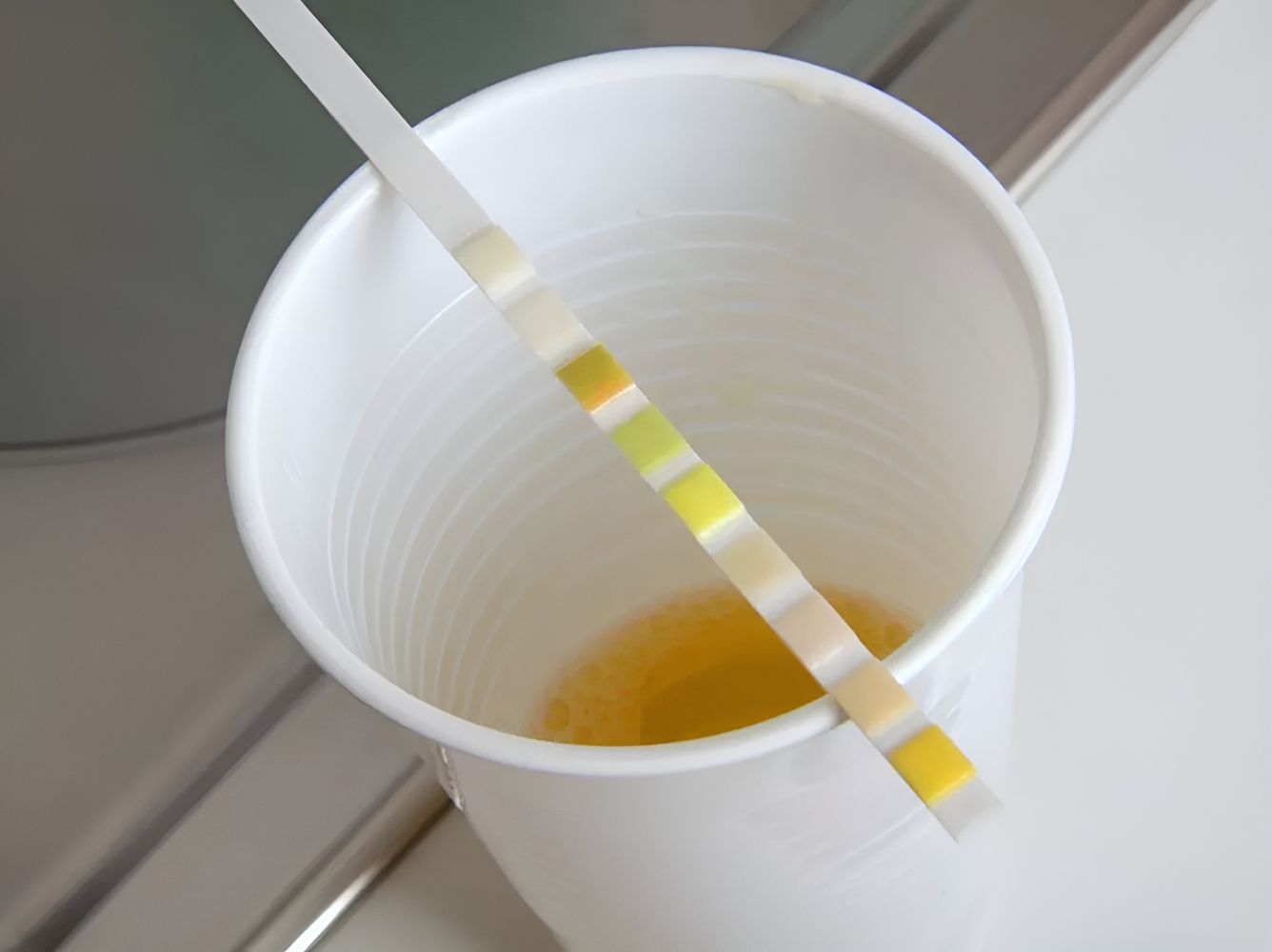 Plastikbecher mit Teststreifen auf einer weißen Fläche